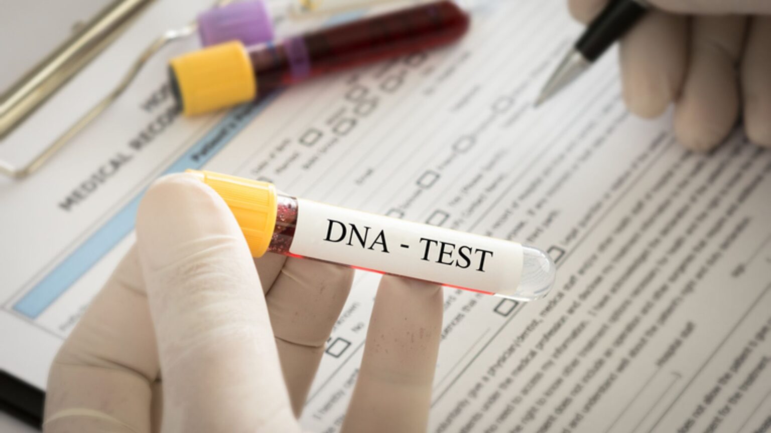4 Pros and Cons of Using DNA SelfTesting Kits Chicago Together